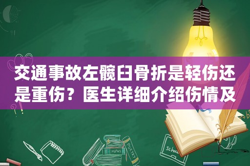 交通事故左髖臼骨折是輕傷還是重傷？醫(yī)生詳細(xì)介紹傷情及處理方法